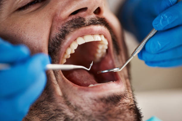 Best After-Hours Dental Trauma Care in Center, CO